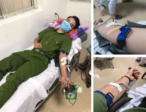 Đoàn Thanh niên Công an tỉnh huy động hiến máu cấp cứu thân nhân cán bộ, chiến sĩ